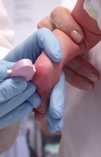 BD Microtainer® MAP para proceso automatizado